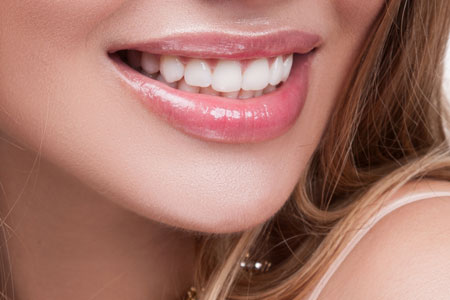 Tooth Bonding Smile Girl with teeth bonded