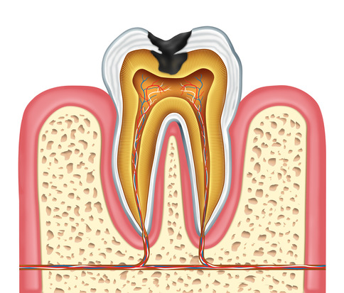 Inner Anatomy of a Cavity