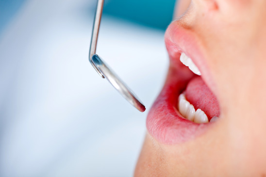 Oral Cancer Screening Close up Patients Mouth