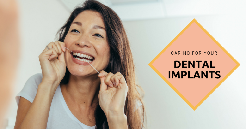 Caring for Your Dental Implants Caring for Your Dental Implants