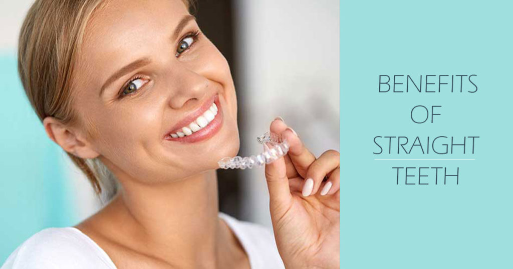Benefits of Straight Teeth Benefits of Straight Teeth