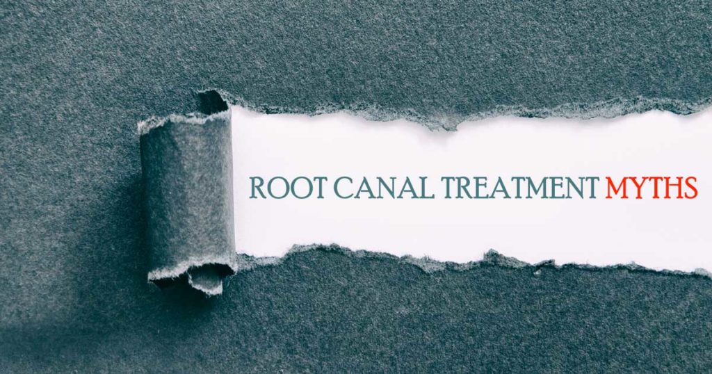 root canal therapy