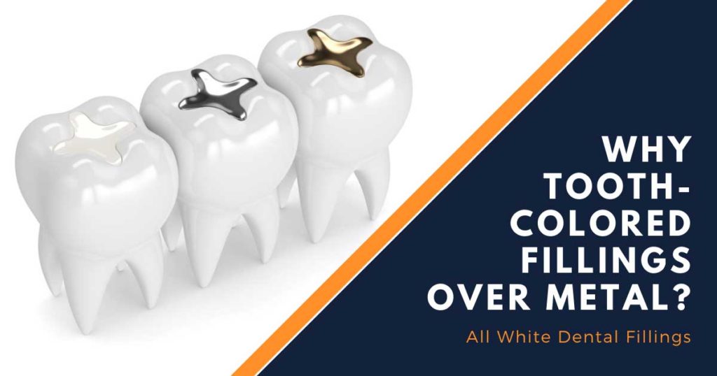Why Tooth Colored Fillings Over Metal Fillings Why Tooth Colored Fillings Over Metal Fillings