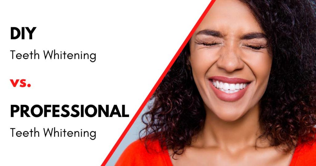 DIY Teeth Whitening vs. Professional Teeth Whitening Women with White Teeth DIY Teeth Whitening vs. Professional Teeth Whitening Women with White Teeth
